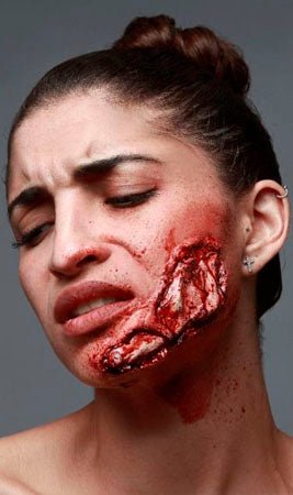 Ferita Guancia lattice